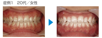 �z���C�g�j���O